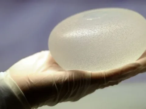 Barely tested implants caused nearly 83,000 deaths worldwide
