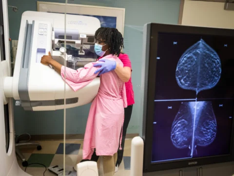 Artificial intelligence is better at detecting cancer than radiologists